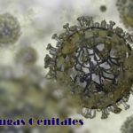 verrugas genitales
